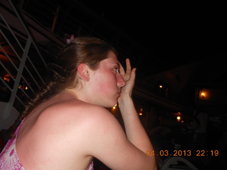 Aruba Sunburn Aruba Sunburn